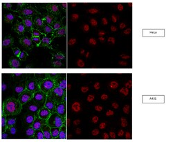 RNF168 Rabbit anti-Human, Mouse, Polyclonal, MilliporeSigma 100&mu;g; Unlabeled:Antibodies,
